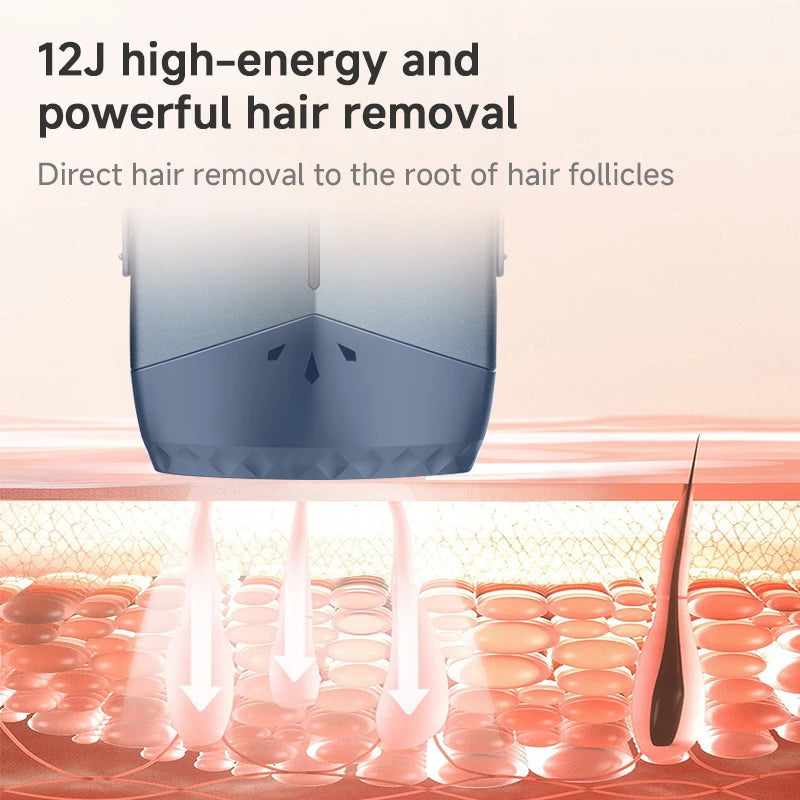 Mlay T18 ICE Cooling Hair Removal Device With Unlimited Shots Permanent IPL Laser Home Use Painless Epilator For Women Men Quick Pick Grocers