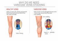 Compression Socks Varicose Veins Men's And Women's Sports Socks Football 20-30 Mmhg Elastic Anti Fatigue Pain Relief Wholesale Quick Pick Grocers