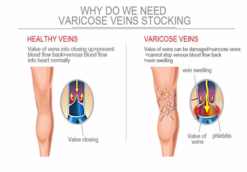 Compression Socks Varicose Veins Men's And Women's Sports Socks Football 20-30 Mmhg Elastic Anti Fatigue Pain Relief Wholesale Quick Pick Grocers