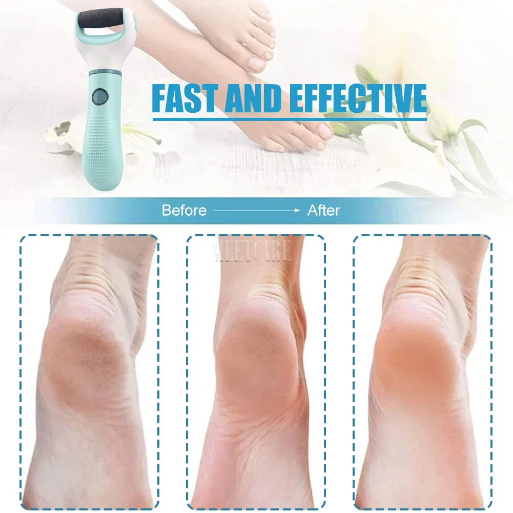Electric Foot Grinder Auto Wireless Remove Dead Skin Calluses Cracks Hard Cracked skin Pedicure Tool Waterproof Foot Cleaner Econic Blanks